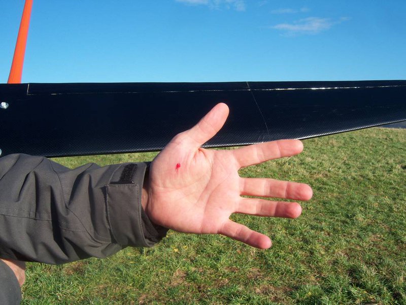 Naja, kaputtes Fleisch!!!